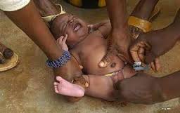 muslimsk omskärelse